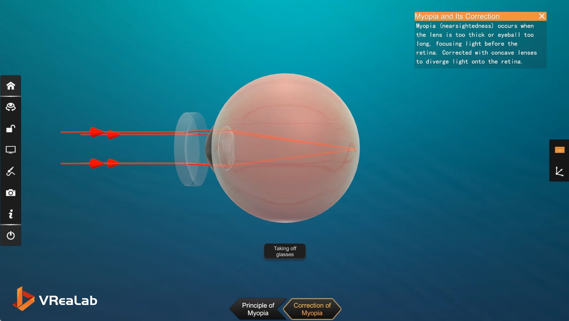 Myopia and its correction VR optics experiment